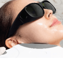 AlmaLASE Laser Facial 3 Sessions First Time Trial