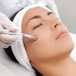Diamond Peel Facial